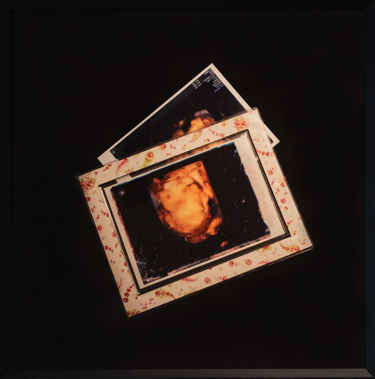 Image of a ultrasound picture of baby in the womb